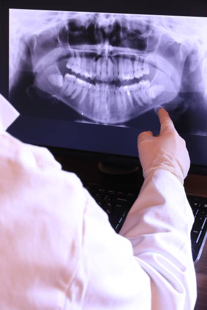 Best Dentist for Tooth Abscess  in New Smyrna Beach, FL