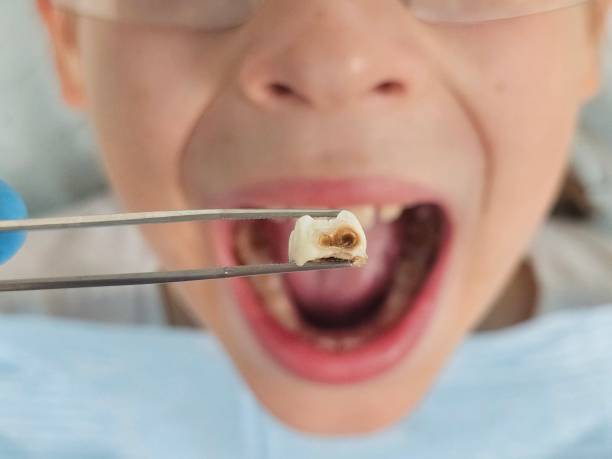 Best Emergency Pediatric Dentist  in New Smyrna Beach, FL