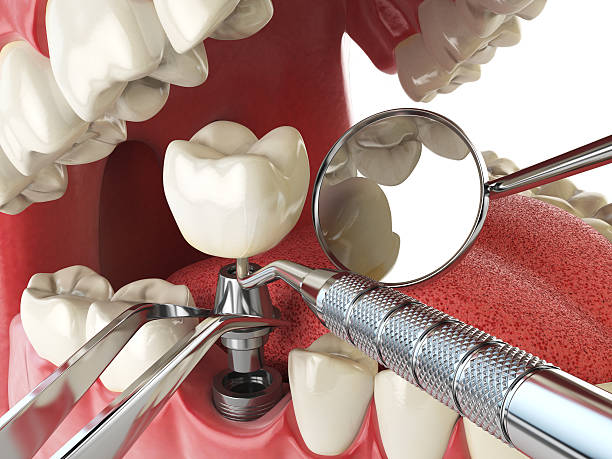 Best Knocked-Out Tooth Emergency  in New Smyrna Beach, FL